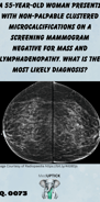 breast screening mammogram with microcalcifications