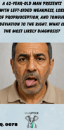 a middle-aged arabic male with unilateral facial weakness and right-sided tongue deviation