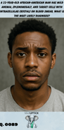 a young adult African American male with pale conjunctiva due to anemia has a concerned expression