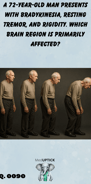 a progressive instances image of an elderly man aging as his posture becomes more stooped over