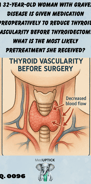 an illustration of a patient's neck showing the thyroid and major blood vessels