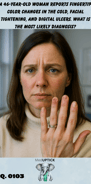 a Caucasian woman with ulcerations on the tips of her fingers