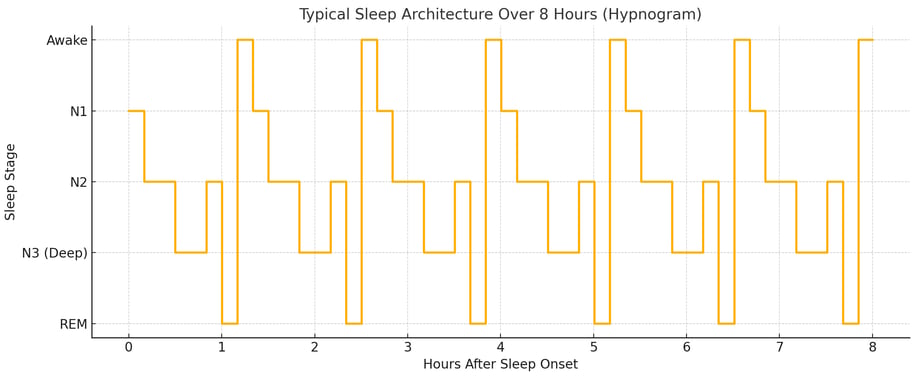 A graph of a Typical Sleep Architecture over 8 Hours (Hypnogram)
