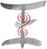 Lemniscate Processus ostéopathe toulon