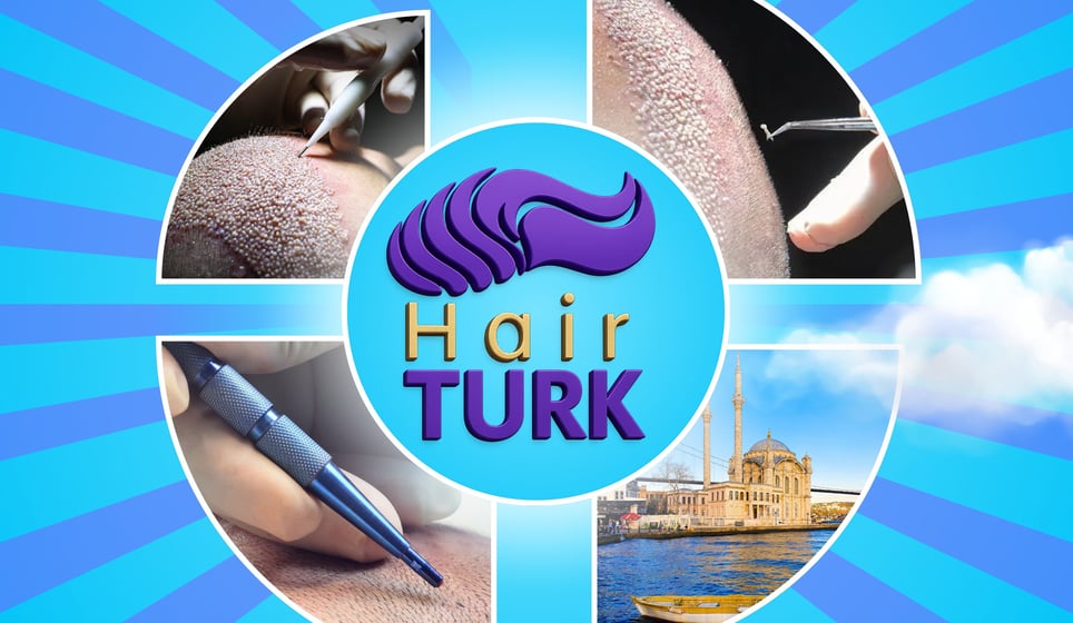 HairTurk hair transplant clinic in Istanbul, Turkey: Procedure tools, scalp, medical tourism.