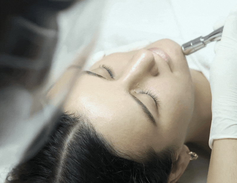 GIF of woman getting diamond tip microdermabrasion around her chin