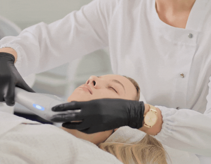 GIF video demonstration of woman getting HIFU treatment in her under chin jaw area